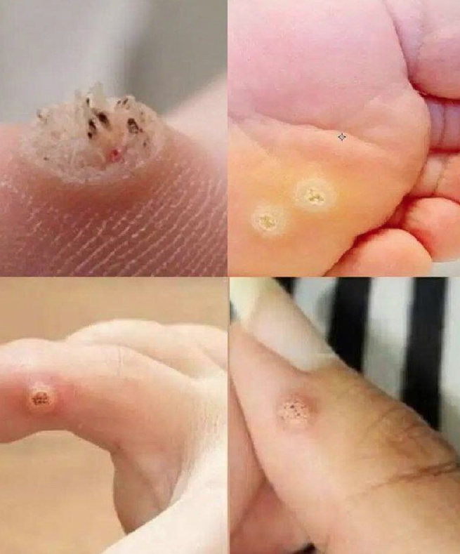 Warning Signs on Your Skin You Should Never Ignore: What to Watch and When to Act